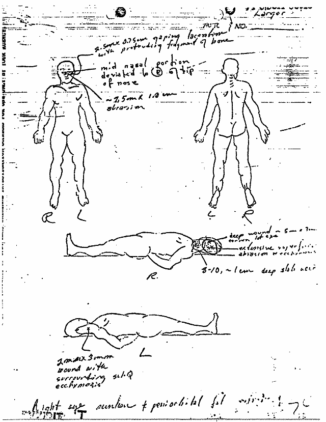 February 17, 1970: Certificate of Death and Autopsy Protocol for Kimberley MacDonald; page 7 of 13