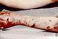 Wounds to left arm of Colette MacDonald