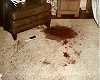 Blood stains on rug in east bedroom